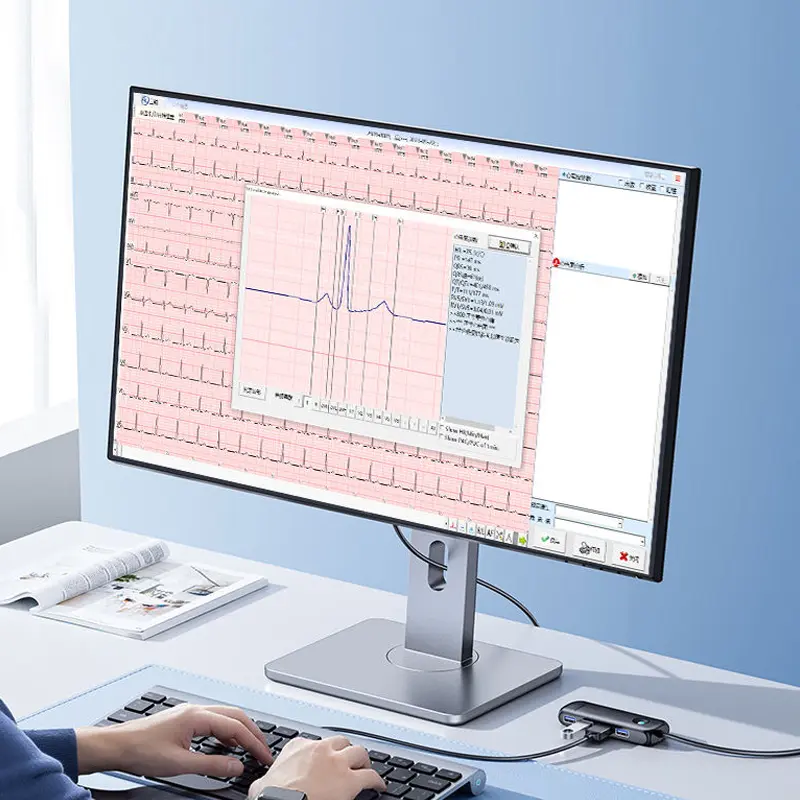 Custom-ECG Paper 48mm 80mm 90mm Hospital ECG Roll Thermal Paper (3).png